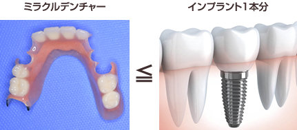 ミラクルデンチャー